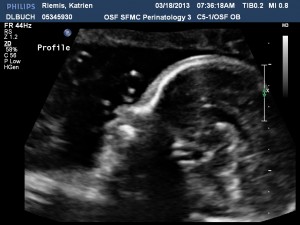 Rosalie Echo